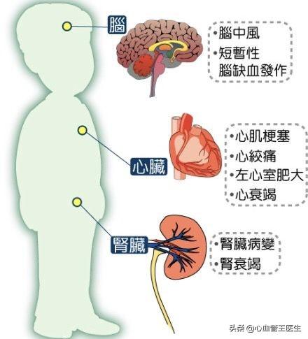 66歲吃著三七粉，血壓180/110，還發(fā)生了腦梗死！為何？