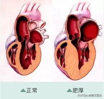 科普：人人都能看明白，自己的心脏这个样子！比喻很形象