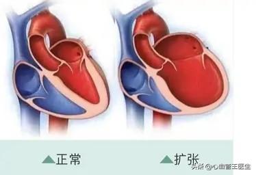 科普：人人都能看明白，自己的心脏这个样子！比喻很形象