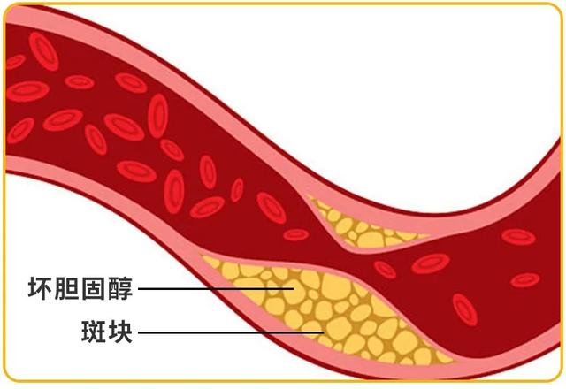 最新消息，医生推荐的这个“水果之王”能降低胆固醇？