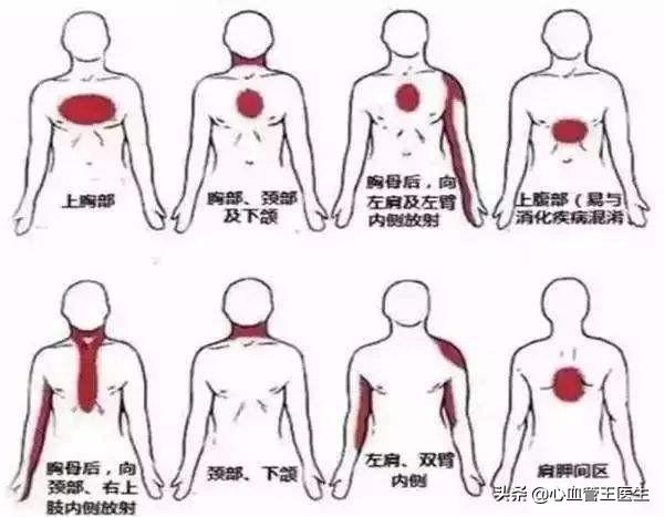 20岁女生心电图提示心肌缺血！这可怎么办？医生看完她放心了