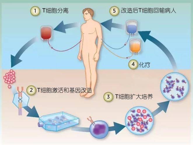 治療白血病 除了砒霜還有什么？