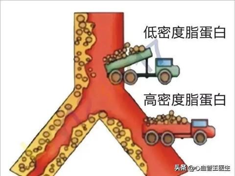 低密度脂蛋白這個(gè)血脂升高，如果不吃藥多久會引起心腦血管疾??？