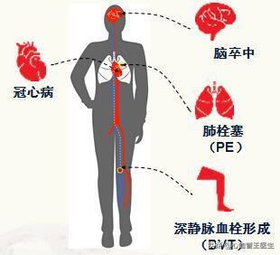 生活中有这10个习惯，说明心脑血管疾病已经上门！具体指哪10习惯