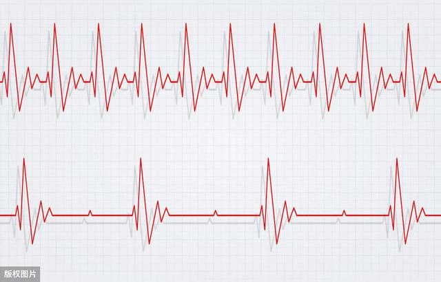 心脏每分钟跳多少次最理想？最长寿？心血管医生给出准确回答！