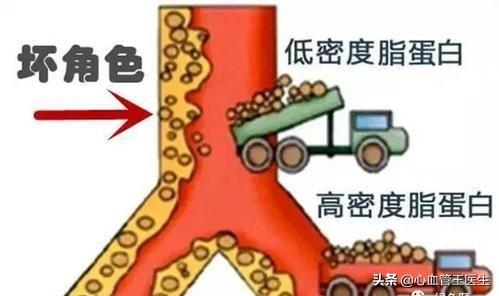 低密度脂蛋白胆固醇，源源不断制造血管垃圾！降到多少最安全？