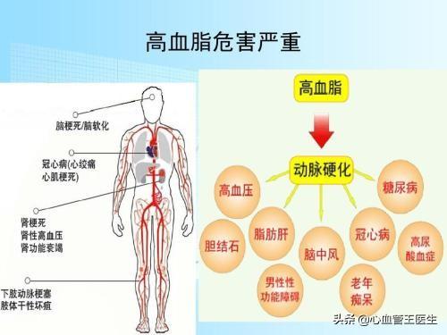 低密度脂蛋白胆固醇，源源不断制造血管垃圾！降到多少最安全？