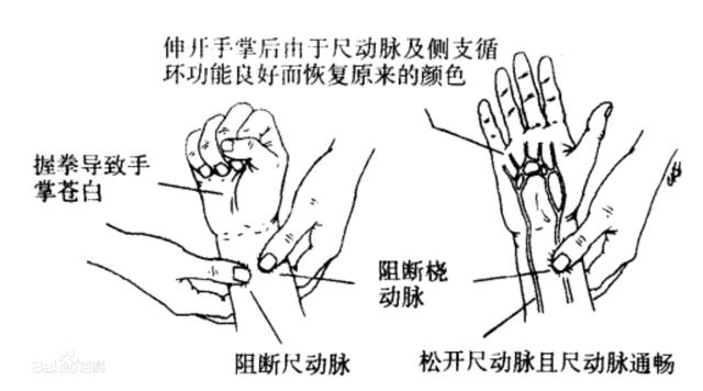 血管堵塞会致命，血管堵塞前手脚先有表现和改变？具体是哪些表现