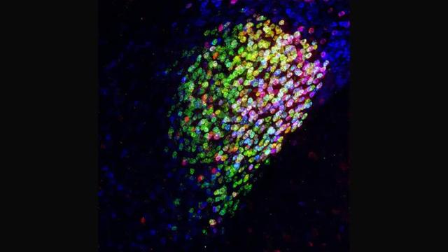 高压下量子自旋液体出现？对身高影响最大的基因突变 | 科技速览