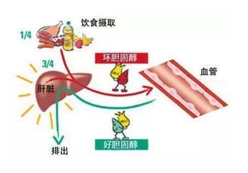 我國(guó)8%死亡原因，是血脂中這個(gè)指標(biāo)升高導(dǎo)致！醫(yī)生告訴您如何降低
