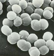 球菌的扫描电镜照片（×20，000）