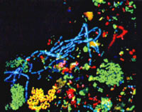 染色法观察到的活性污泥中的细菌群落，每种颜色代表一类细菌