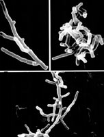 诺卡氏菌属的菌丝断裂形态。左上、下图：基内菌丝；右上：断裂成球状或杆状细胞