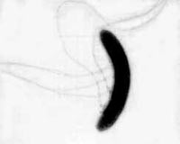 弧菌鞭毛的电镜照片