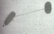 细菌纤毛的电镜照片