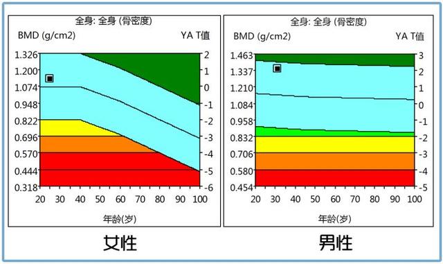 老人和小孩補鈣有用嗎？青年人不用補鈣嗎？