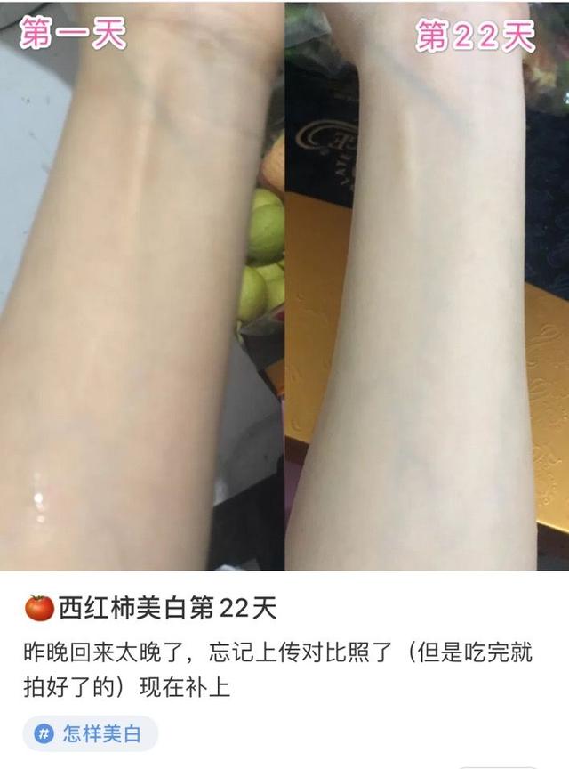 每天吃西红柿真的能美白吗？