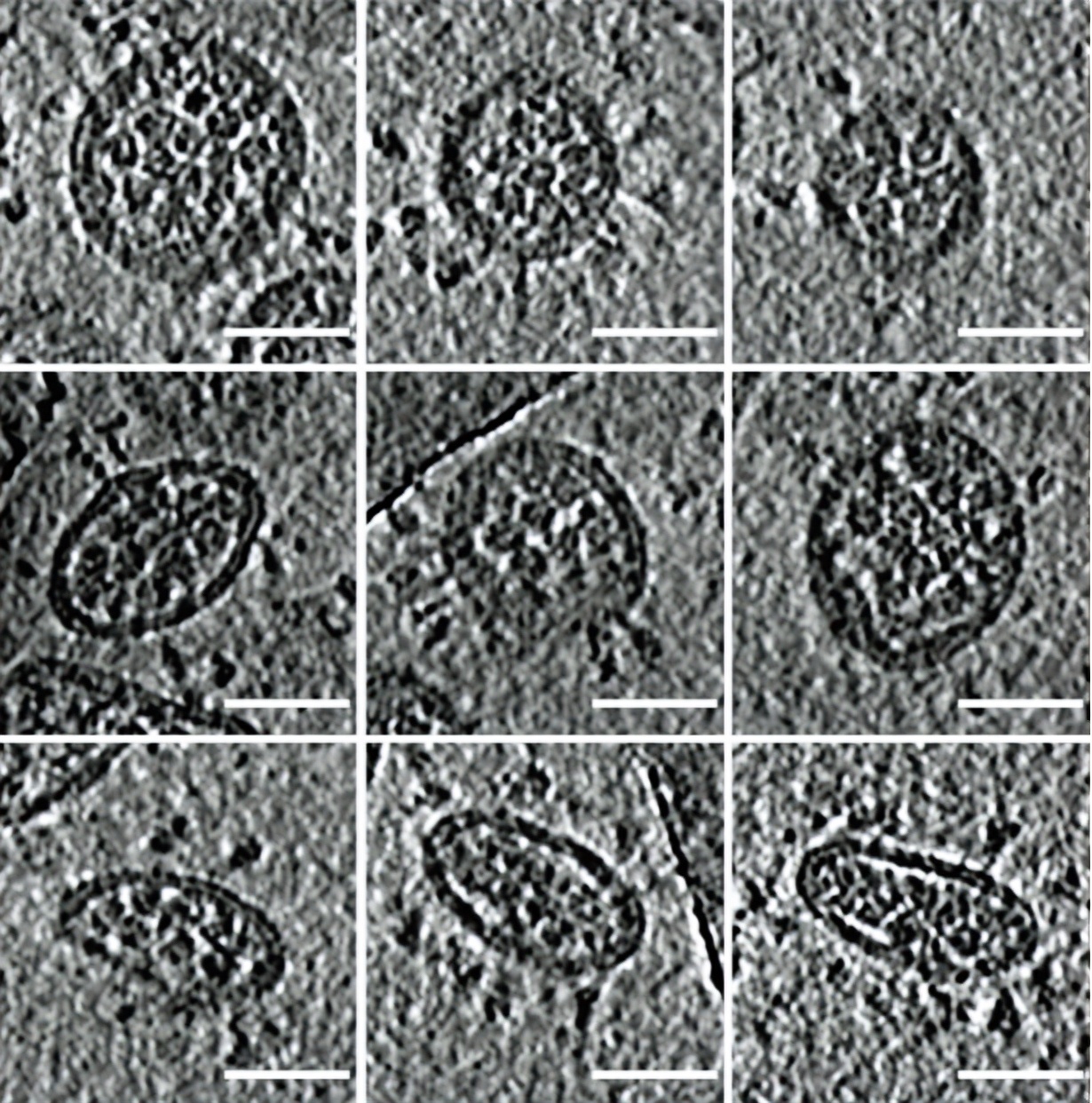 结构生物学的下一个突破：cryo-ET