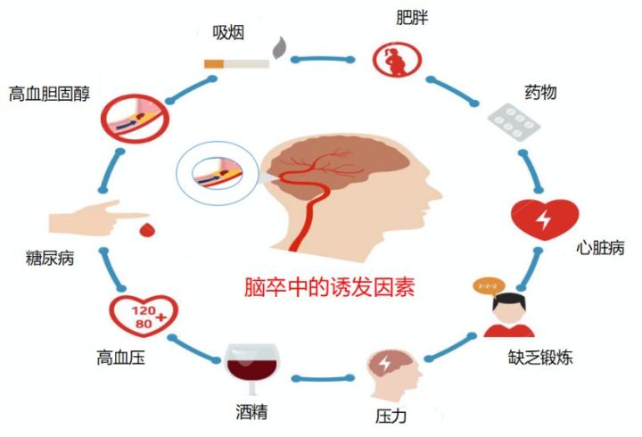 脑卒中，怎么念？怎么防？怎么判断？你可能一样都没搞清楚