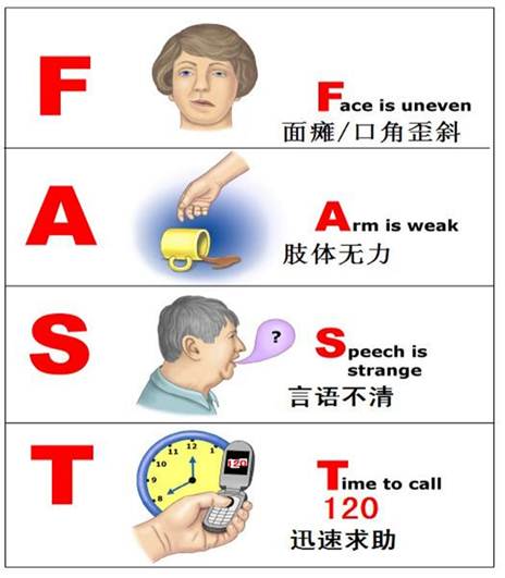 腦卒中，怎么念？怎么防？怎么判斷？你可能一樣都沒(méi)搞清楚