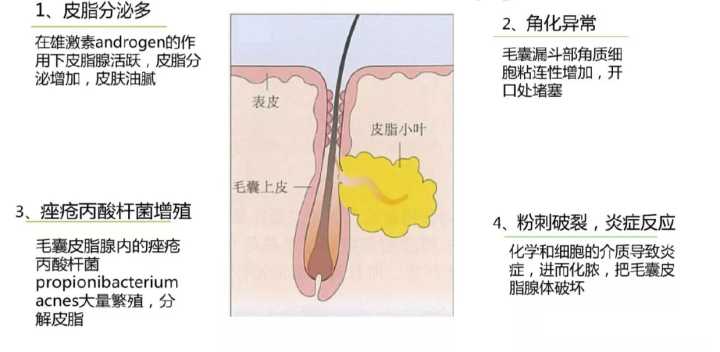 刷酸的你，选对了吗？