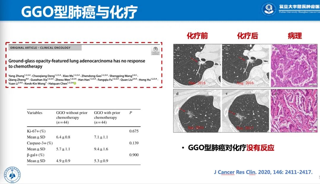 你知道吗？这种肺癌对化疗不敏感