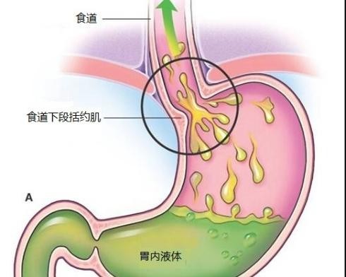 食道卡通图片可爱图片