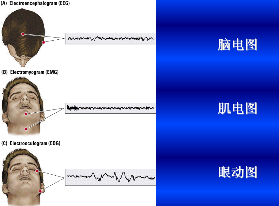 世界睡眠日 | 全国超3亿人有睡眠障碍，怎样才能睡个好觉？