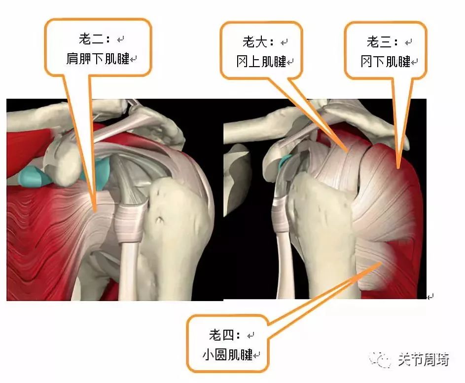 肩痛不等于肩周炎有一种痛叫肩袖损