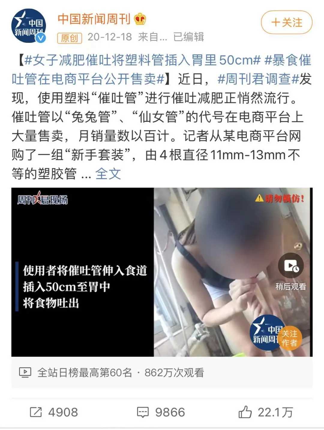 减肥催吐管公开售卖？揭露催吐背后的危害