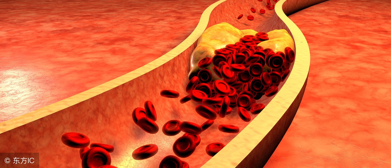 关于胆固醇你一定要知道的三件事