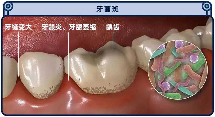 实测13款热门电动牙刷，到底哪款刷得更干净？