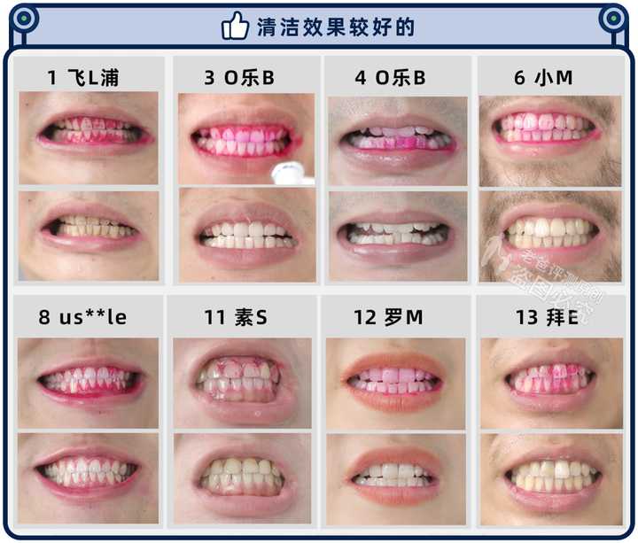 实测13款热门电动牙刷，到底哪款刷得更干净？