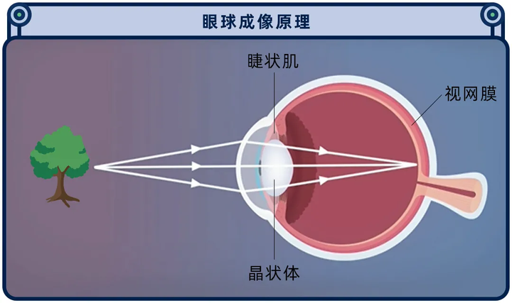 被吹上天的近视手术，为什么很多眼科医生自己都不做？