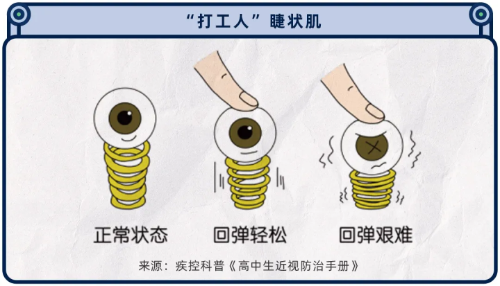 被吹上天的近视手术，为什么很多眼科医生自己都不做？