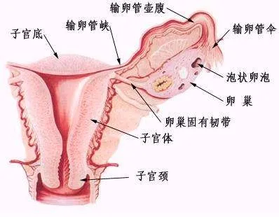 千万别入盆腔积液这个坑