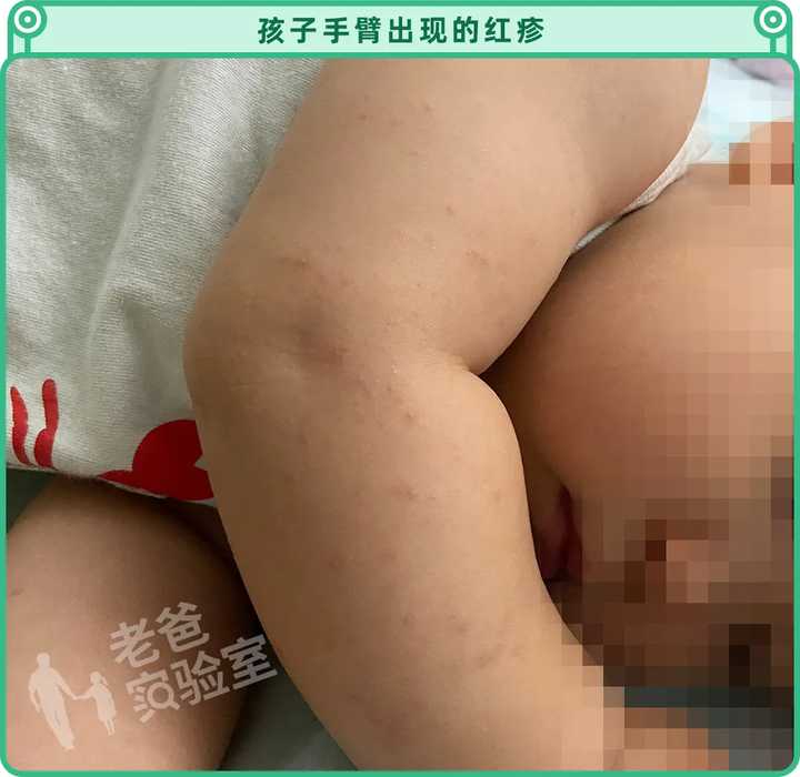 兩個孩子接連起紅疹，一張爬爬墊危害竟然這么大？