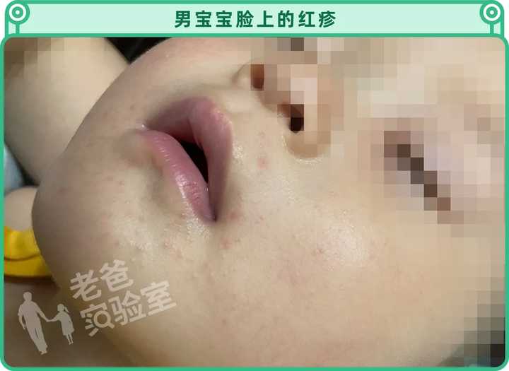兩個孩子接連起紅疹，一張爬爬墊危害竟然這么大？