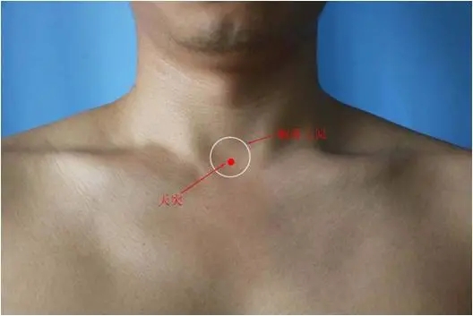 锁骨中线第二肋间定位图片