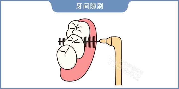 冲牙器到底有没有用？是智商税吗？