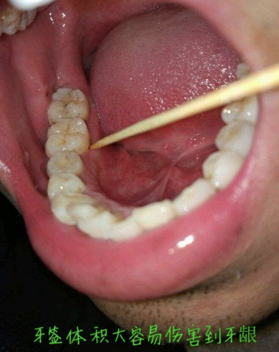 骨质疏松？胃病？心脏病？口腔科医生告诉你，早这么做还来得及