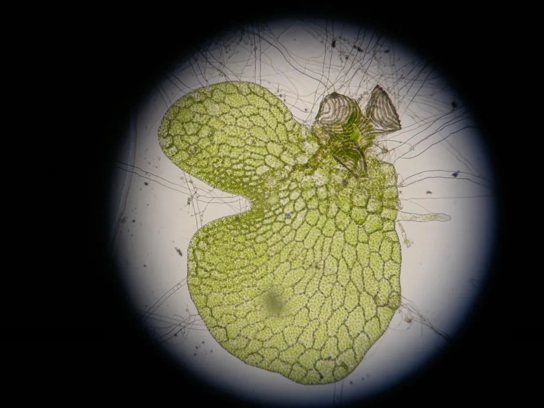 蕨的孢子囊环带示意图图片