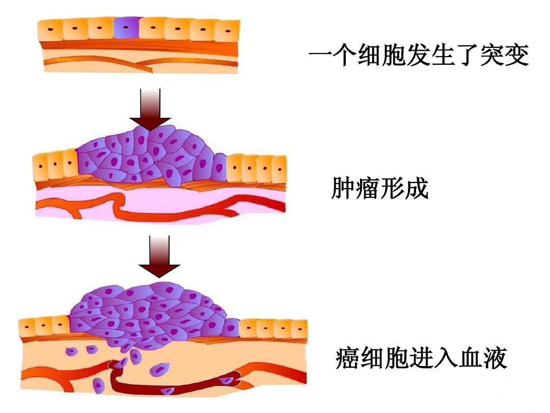 想要一生不患癌癥，是否有可能？醫(yī)生給出這幾點建議，請收藏