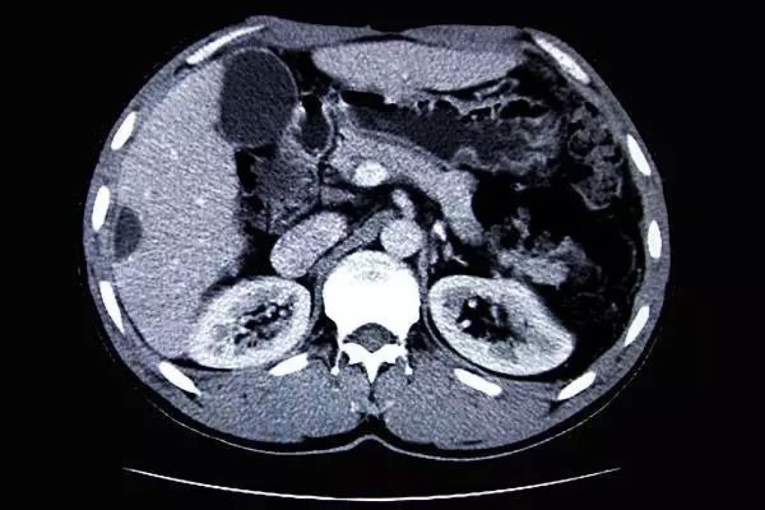 X线、CT、MRI、B超有什么区别