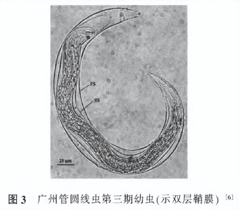 福寿螺体很容易寄生广州管圆线虫,一只福寿螺体内寄生的广州管圆线