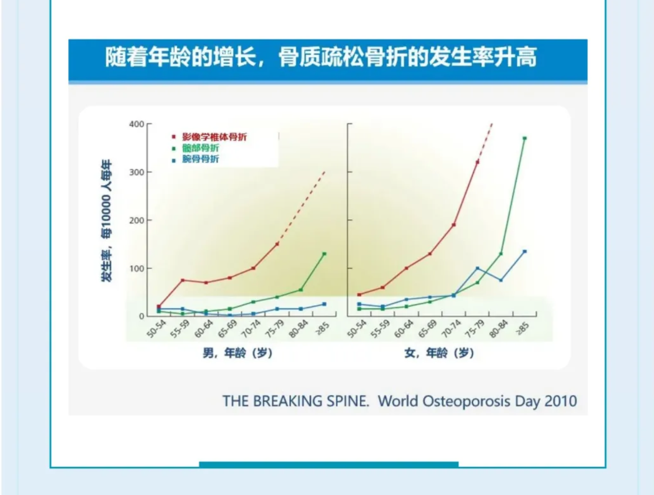 骨质疏松症：多么痛的领悟