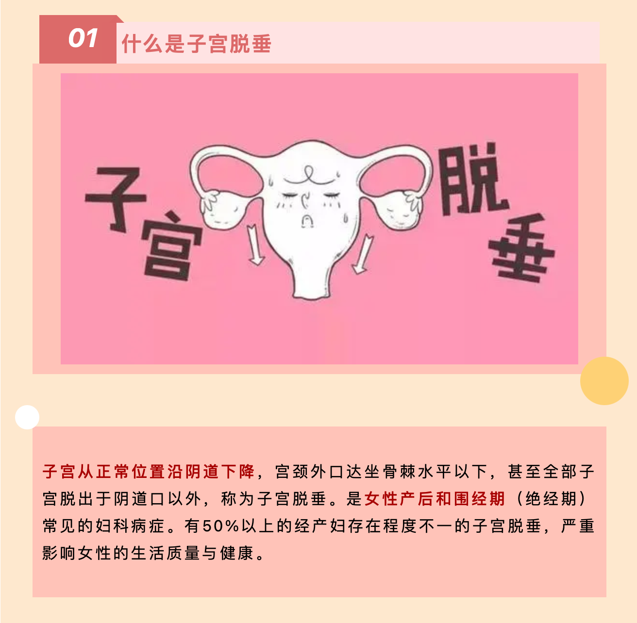產(chǎn)后小腹總有下墜感，要警惕子宮脫垂啦