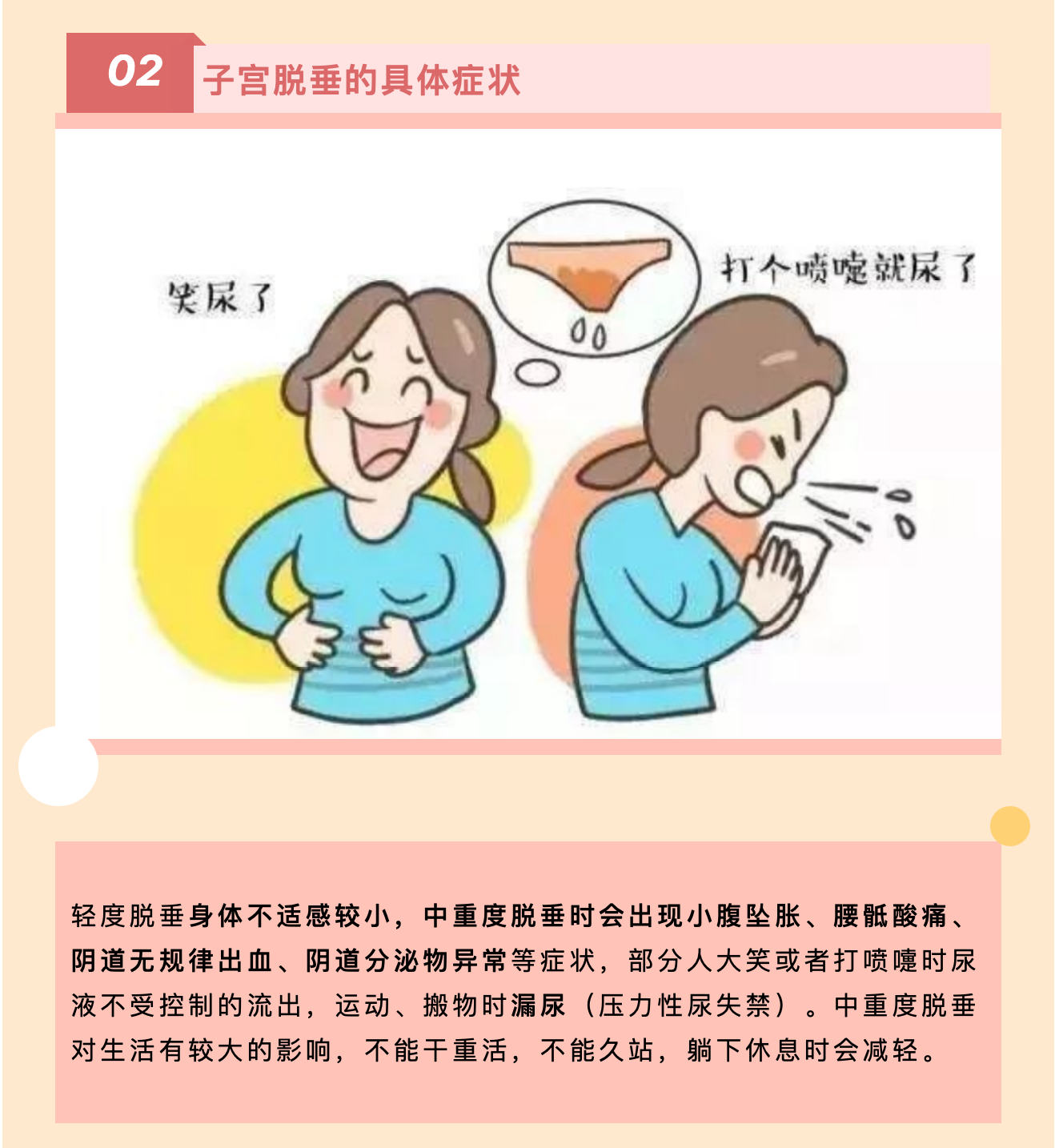 產(chǎn)后小腹總有下墜感，要警惕子宮脫垂啦