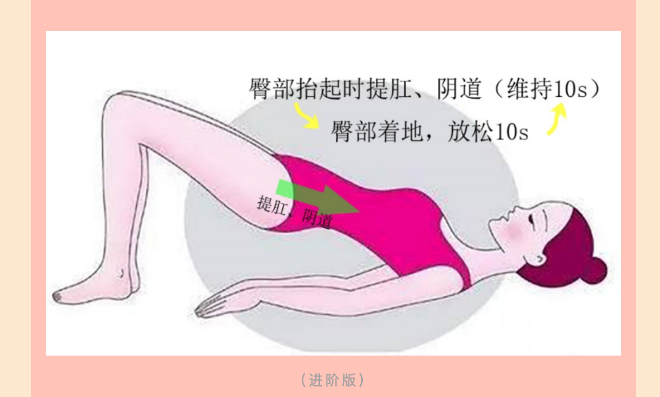產(chǎn)后小腹總有下墜感，要警惕子宮脫垂啦