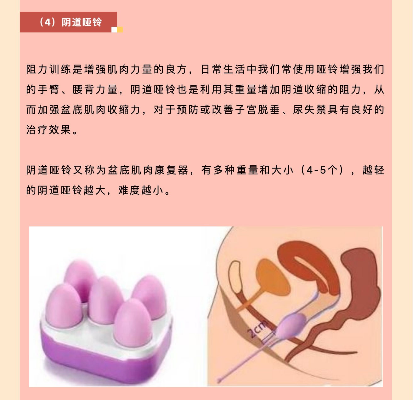 產(chǎn)后小腹總有下墜感，要警惕子宮脫垂啦